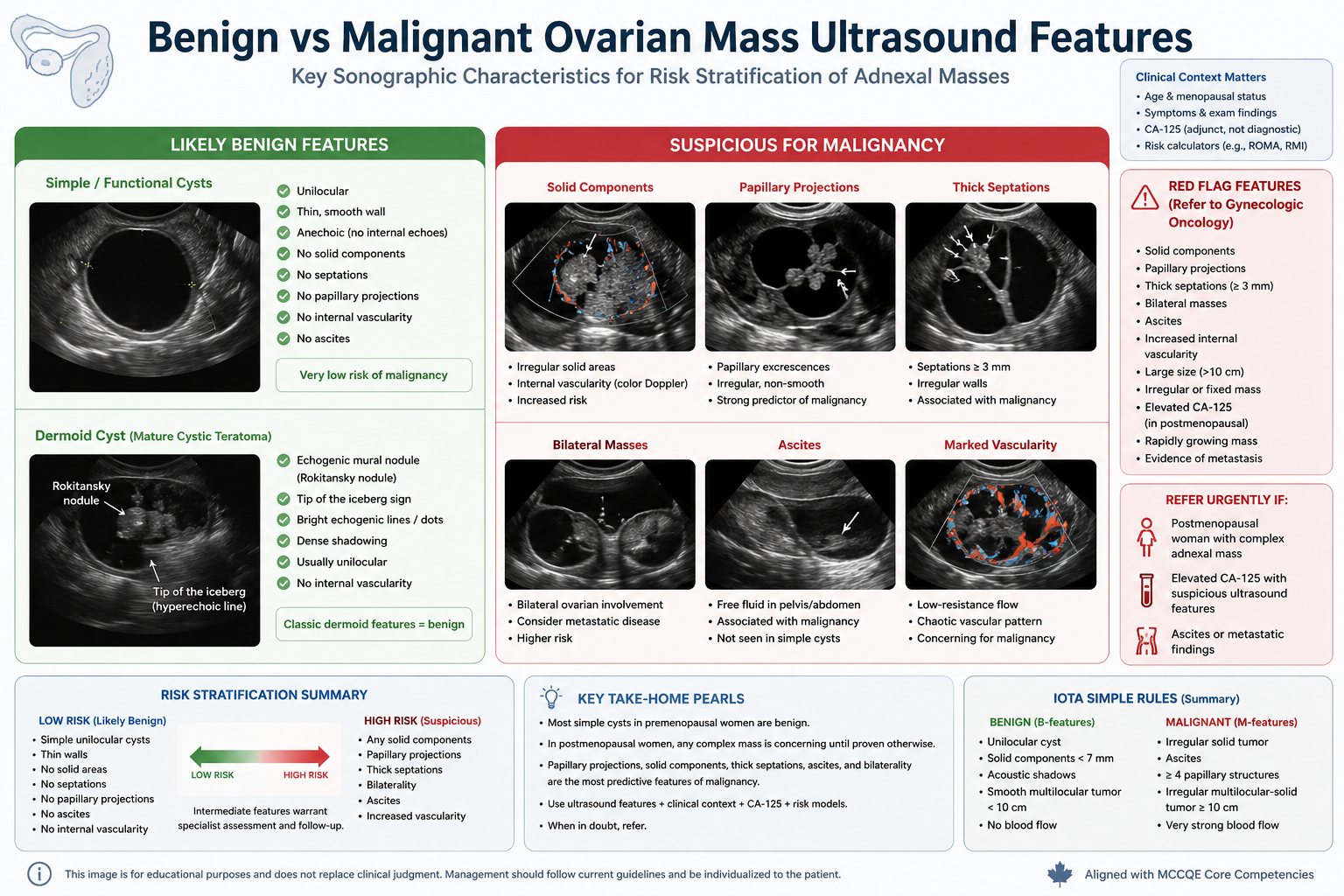 Premature Ovarian Insufficiency — clinical illustration