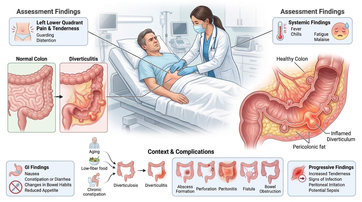 Diverticulitis — clinical illustration